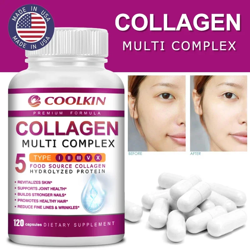 Coffee X - Collagen Multi Complex - typy I,